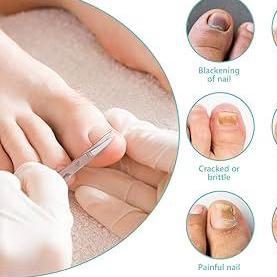 OrivelleNail FungusPen