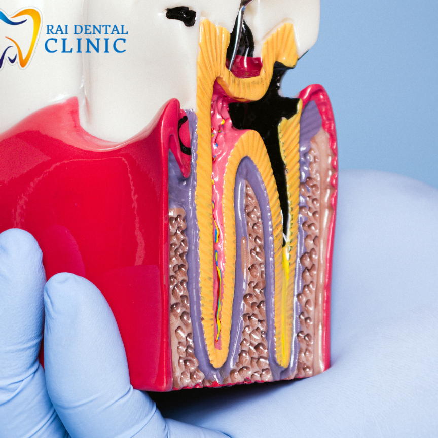 Rai Dental Clinic